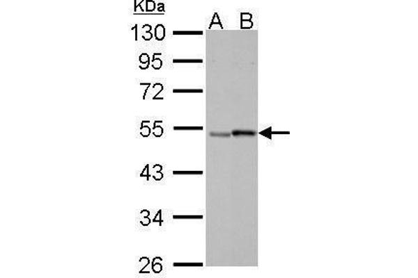 anti-Retinoic Acid Receptor, gamma (RARG) (Center) antibody