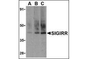 Image no. 2 for anti-Single Immunoglobulin and Toll-Interleukin 1 Receptor (TIR) Domain (SIGIRR) (C-Term) antibody (ABIN500712)