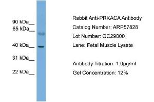 Image no. 2 for anti-Protein Kinase A, alpha (PRKACA) (N-Term) antibody (ABIN2787416)