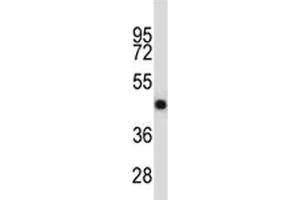 Image no. 1 for anti-Tumor Necrosis Factor Receptor Superfamily, Member 11b (TNFRSF11B) (AA 243-271) antibody (ABIN3029353)