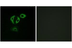 Image no. 3 for anti-Transforming, Acidic Coiled-Coil Containing Protein 3 (TACC3) (AA 789-838) antibody (ABIN1535500)