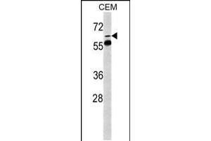 Image no. 1 for anti-FK506 Binding Protein 10, 65 KDa (FKBP10) (AA 57-87), (N-Term) antibody (ABIN5531170)