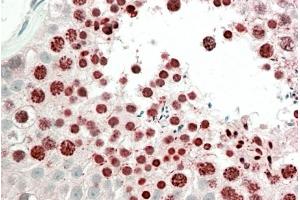 Image no. 4 for anti-Homeobox A10 (HOXA10) (Internal Region) antibody (ABIN1590026)