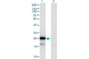 Image no. 4 for anti-Ubiquitin-Conjugating Enzyme E2G 2 (UBE2G2) (AA 1-87) antibody (ABIN563321)