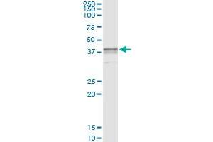 Image no. 1 for anti-Bone Marrow Stromal Cell Antigen 1 (BST1) (AA 1-318) antibody (ABIN513814)