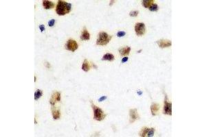 Image no. 2 for anti-Fragile X Mental Retardation 1 (FMR1) antibody (ABIN2966645)