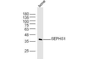 Image no. 1 for anti-Selenophosphate Synthetase 1 (SEPHS1) (AA 2-100) antibody (ABIN5675097)