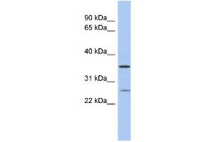 Image no. 1 for anti-Short Chain Dehydrogenase/reductase Family 9C, Member 7 (SDR9C7) (Middle Region) antibody (ABIN2785132)