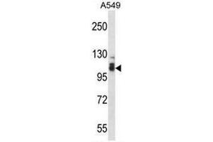 Image no. 1 for anti-SMEK Homolog 2, Suppressor of Mek1 (Dictyostelium) (SMEK2) (AA 719-748), (C-Term) antibody (ABIN954852)