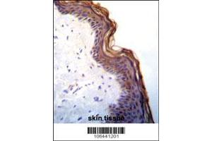 Image no. 2 for anti-Kallikrein 7 (KLK7) (AA 157-187), (C-Term) antibody (ABIN652198)