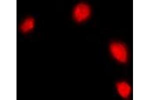 Image no. 2 for anti-Interferon, gamma-Inducible Protein 16 (IFI16) (full length) antibody (ABIN6043560)