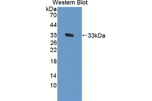 Image no. 1 for anti-Feline Sarcoma Oncogene (FES) (AA 509-766) antibody (ABIN5013542)