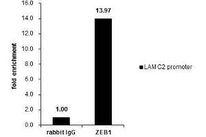 Image no. 3 for anti-Zinc Finger E-Box Binding Homeobox 1 (ZEB1) (Internal Region) antibody (ABIN2856075)