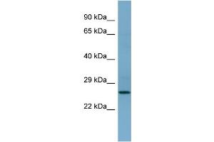 Image no. 2 for anti-APAF1 Interacting Protein (APIP) (Middle Region) antibody (ABIN2786905)