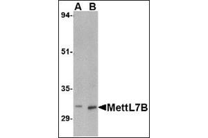 Image no. 2 for anti-Methyltransferase Like 7B (METTL7B) (C-Term) antibody (ABIN500276)