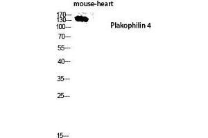 Image no. 1 for anti-Plakophilin 4 (PKP4) (Internal Region) antibody (ABIN3186496)