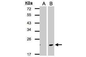 WB Image Western Blot analysis of DPT expression in transfected 293T cell line by DPT polyclonal antibody.