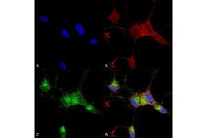 Immunocytochemistry/Immunofluorescence analysis using Mouse Anti-Nav1.