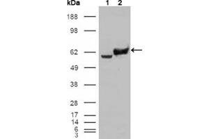 Image no. 2 for anti-Glucose-6-Phosphate Isomerase (GPI) antibody (ABIN1107377)