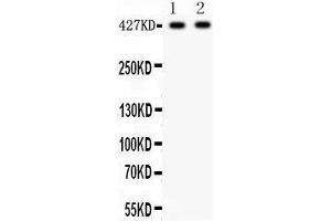 Image no. 3 for anti-Dystrophin (DMD) (AA 3076-3404) antibody (ABIN3043317)