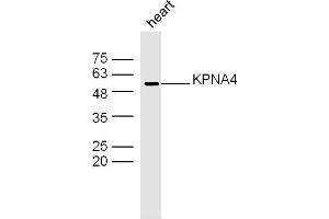 Image no. 1 for anti-Karyopherin (Importin) alpha 4 (KPNA4) (AA 1-100) antibody (ABIN5675543)
