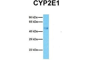 Image no. 2 for anti-Cytochrome P450, Family 2, Subfamily E, Polypeptide 1 (CYP2E1) (C-Term) antibody (ABIN2776801)