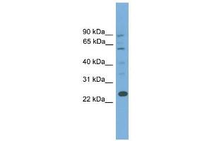 Image no. 1 for anti-B-Cell CLL/lymphoma 7A (BCL7A) (Middle Region) antibody (ABIN632338)
