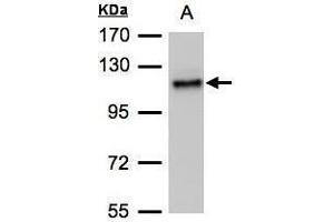 Image no. 2 for anti-ADAMTS-Like 2 (ADAMTSL2) (C-Term) antibody (ABIN2855279)
