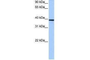 Image no. 1 for anti-Mitochondrial rRNA Methyltransferase 1 Homolog (MRM1) (C-Term) antibody (ABIN2776575)