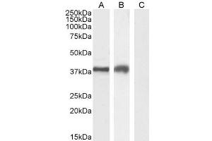 Image no. 3 for anti-Hepatitis A Virus Cellular Receptor 2 (TIM 3) (Internal Region) antibody (ABIN185571)