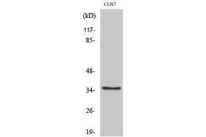 Image no. 1 for anti-Post-GPI Attachment To Proteins 1 (PGAP1) (Internal Region) antibody (ABIN3183562)