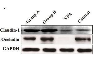 Image no. 1 for anti-Claudin 1 (CLDN1) antibody (ABIN3023187)