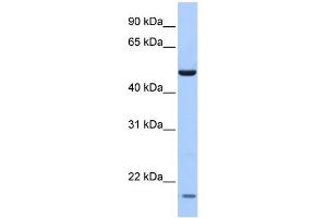 WB Suggested Anti-ZNF764 Antibody Titration:  0.