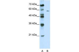 Image no. 1 for anti-BTB (POZ) Domain Containing 14A (BTBD14A) (C-Term) antibody (ABIN2775939)