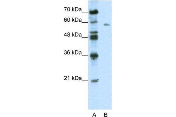 BTBD14A antibody  (C-Term)