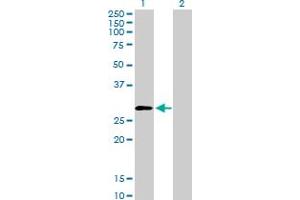 Image no. 1 for anti-Proteasome (Prosome, Macropain) 26S Subunit, Non-ATPase, 9 (PSMD9) (AA 1-223) antibody (ABIN519409)