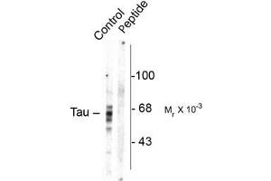 Image no. 1 for anti-Microtubule-Associated Protein tau (MAPT) (pSer416) antibody (ABIN361456)