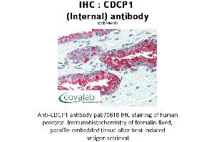 Image no. 2 for anti-CUB Domain Containing Protein 1 (CDCP1) (Internal Region) antibody (ABIN1732917)
