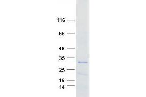 Image no. 1 for Testis Development Related Protein (TDRP) protein (Myc-DYKDDDDK Tag) (ABIN2714160)