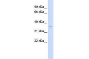 Image no. 1 for anti-PiggyBac Transposable Element Derived 2 (PGBD2) (AA 252-301) antibody (ABIN6743773)