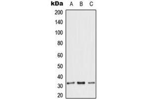 Image no. 2 for anti-Solute Carrier Family 25 (Mitochondrial Carrier, Adenine Nucleotide Translocator), Member 6 (SLC25A6) (Center) antibody (ABIN2705475)