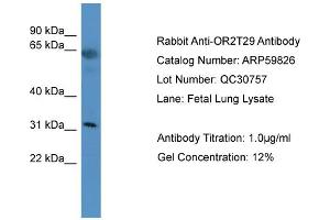 Image no. 2 for anti-Olfactory Receptor, Family 2, Subfamily T, Member 29 (OR2T29) (C-Term) antibody (ABIN2788231)