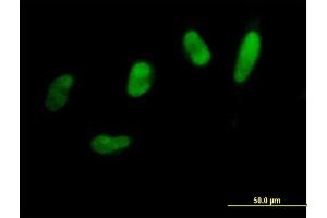Immunofluorescence of purified MaxPab antibody to SNAI2 on HeLa cell.