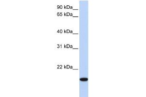 Image no. 1 for anti-Homeobox even-skipped homolog protein 2 (EVX2) (N-Term) antibody (ABIN2787653)