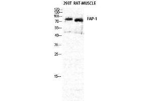 Image no. 1 for anti-Fibroblast Activation Protein, alpha (FAP) (Internal Region) antibody (ABIN3186906)