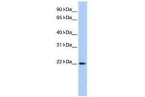 Image no. 1 for anti-Deoxyribonuclease II beta (DNASE2B) (C-Term) antibody (ABIN6743113)