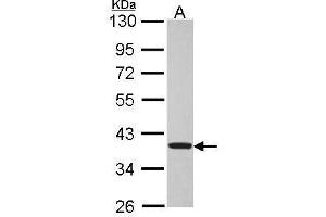 Image no. 1 for anti-Tumor Suppressing Subtransferable Candidate 1 (TSSC1) (Center) antibody (ABIN2856973)