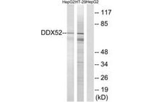 Image no. 1 for anti-DEAD (Asp-Glu-Ala-Asp) Box Polypeptide 52 (DDX52) (AA 550-599) antibody (ABIN1535204)