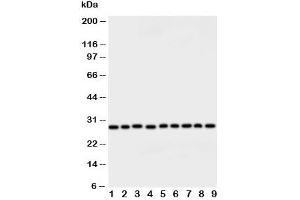 Image no. 5 for anti-Peroxiredoxin 3 (PRDX3) (AA 239-256) antibody (ABIN3032188)