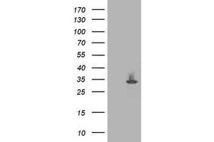 Image no. 2 for anti-Pyridoxamine 5'-Phosphate Oxidase (PNPO) antibody (ABIN2729265)